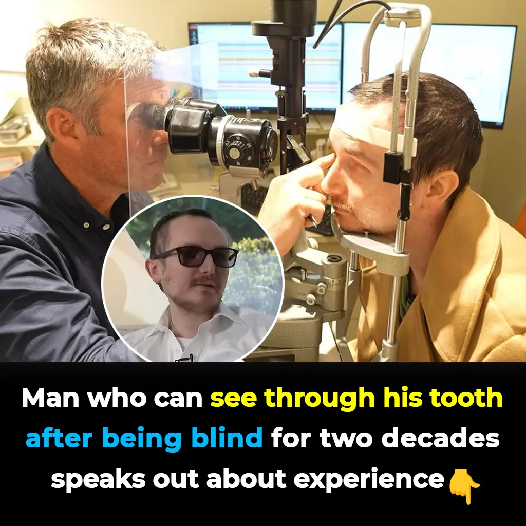 Blind For 20 Years, Man Regains Sight Through His Tooth In Miracle Surgery