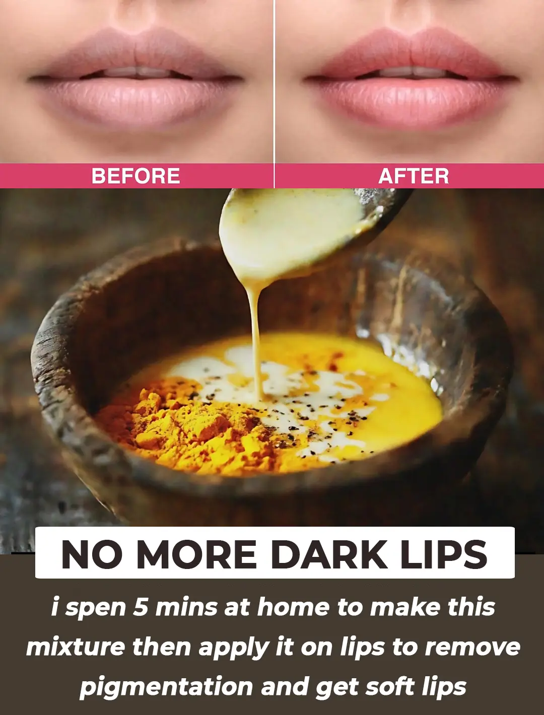 3 Easy Steps to Treat Dark Lips at Home Naturally