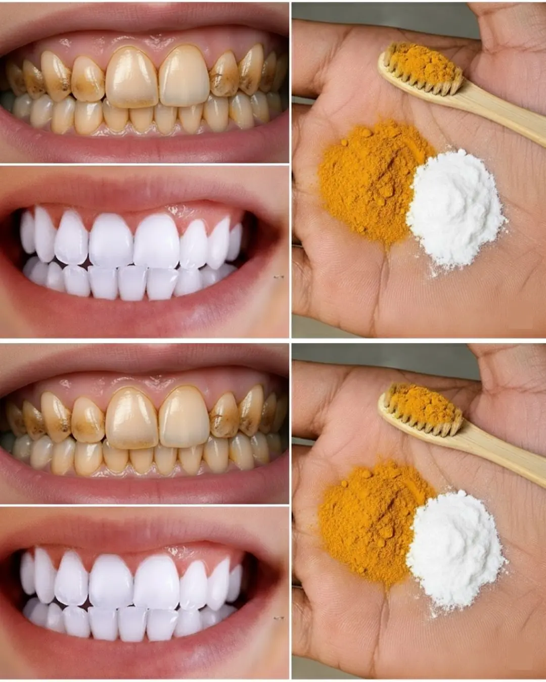 Home Teeth Whitening: Get Whiter Teeth in Just 2 Minutes!