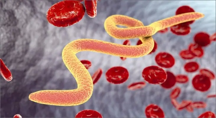 Always Tired, Bloated, or Foggy? This Can Be Why… Follow This Parasite Cleanse Diet