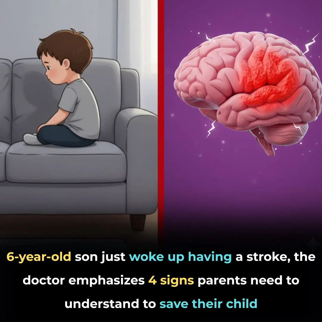 6-year-old son just woke up having a stroke, the doctor emphasizes 4 signs parents need to understand to save their child