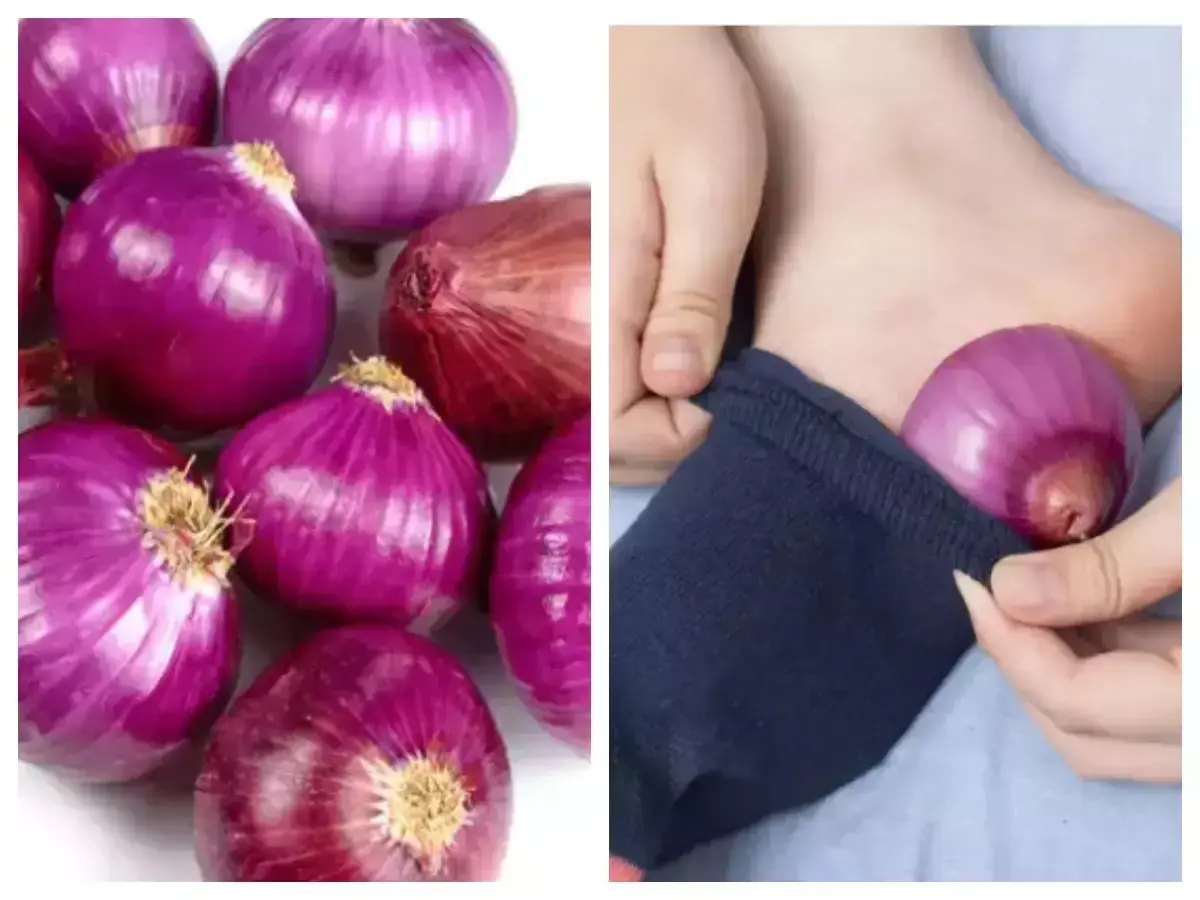 People Are Putting Onions in Their Socks—Here’s Why You Don’t Want to Miss Out