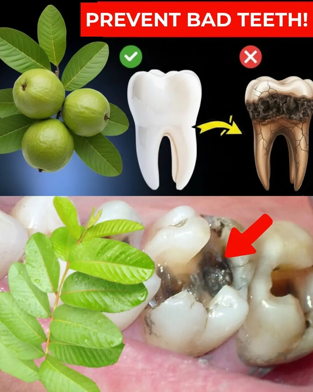 Top 3 Ways to Treat Tooth Decay with Guava Leaves – Simple and Cost-Effective