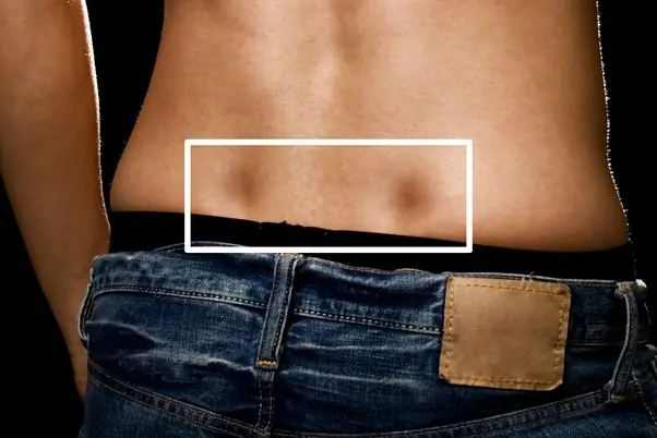 If You Have These Two "Dimples" on Your Lower Back, Here's What They Mean