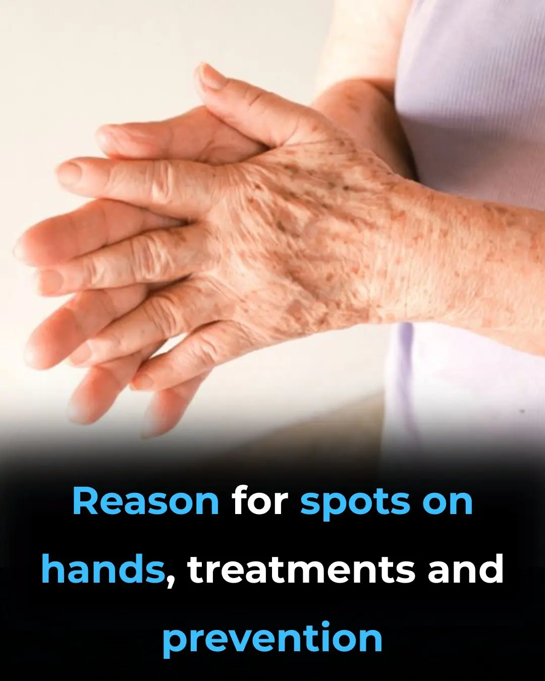 Reason For Spots On Hands