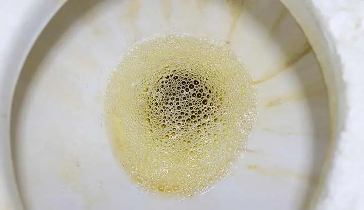 What Foamy Urine Might Be Trying to Tell You