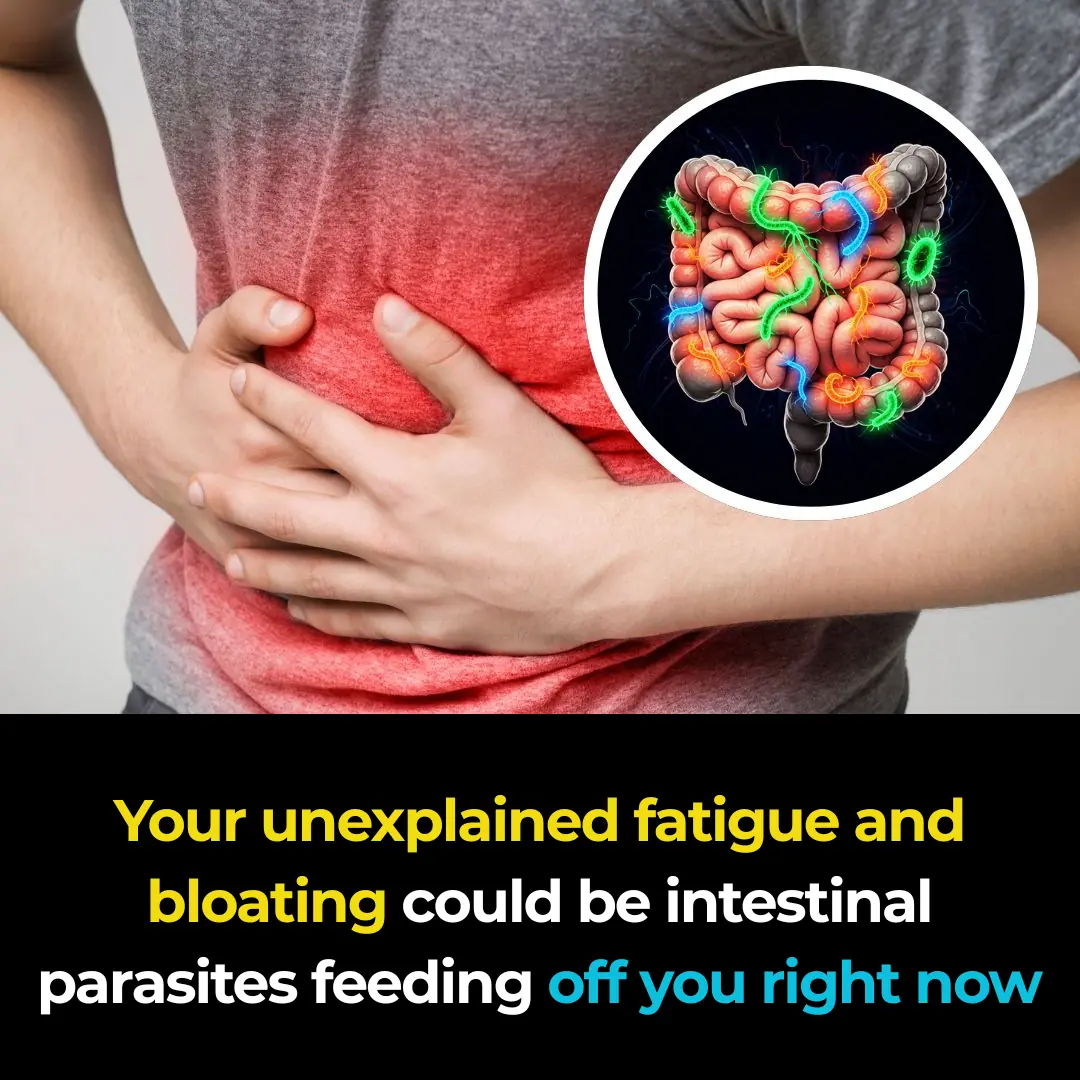 Your unexplained fatigue and bloating could be intestinal parasites feeding off you right now
