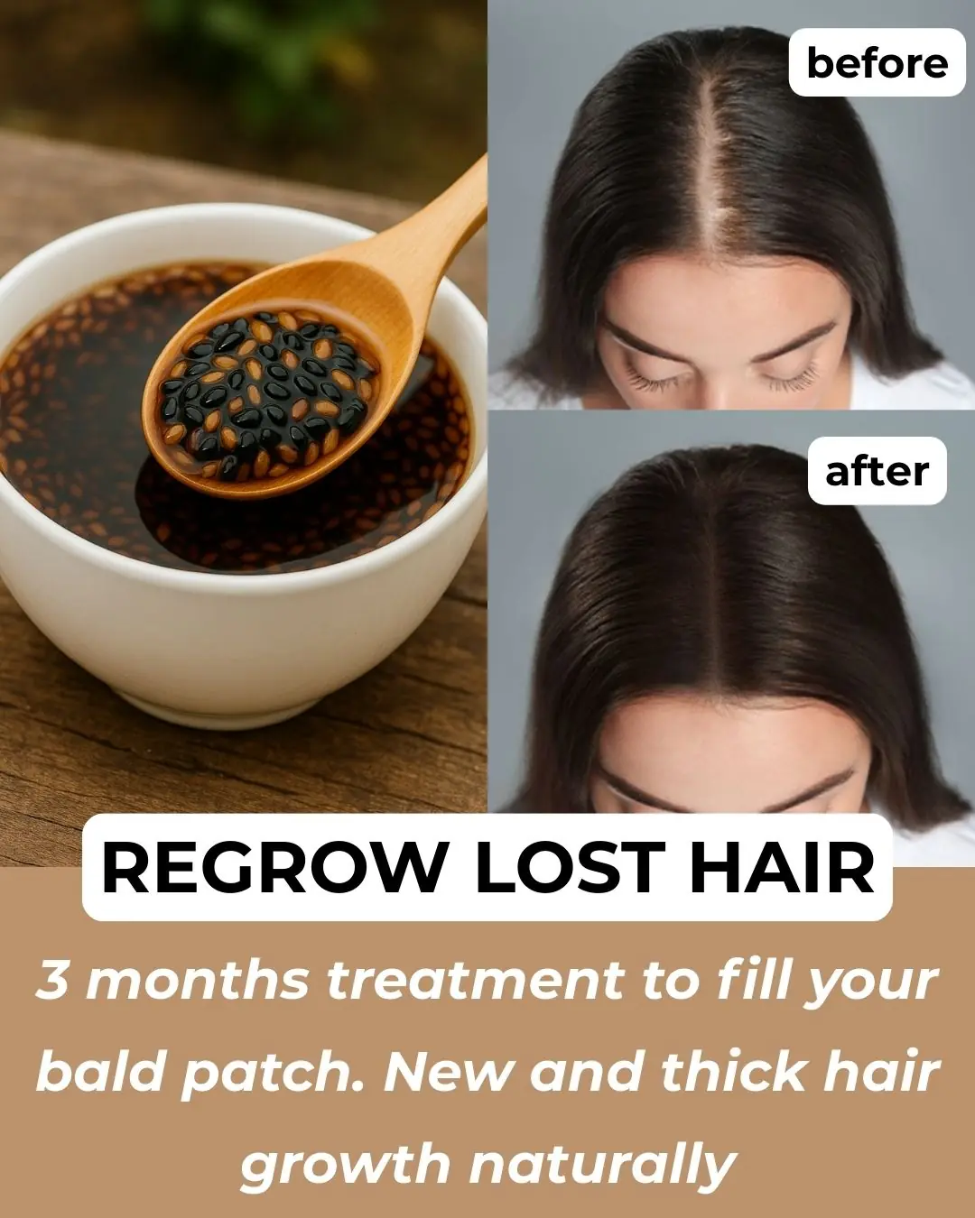 DHT Blocking Gel For Thick Hair Growth