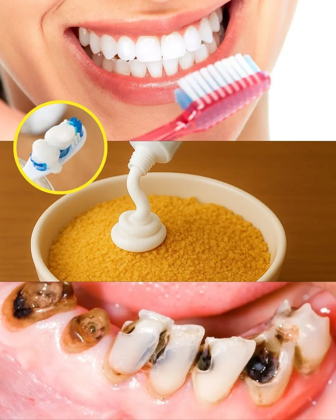 Reverse Cavities Naturally with This Secret
