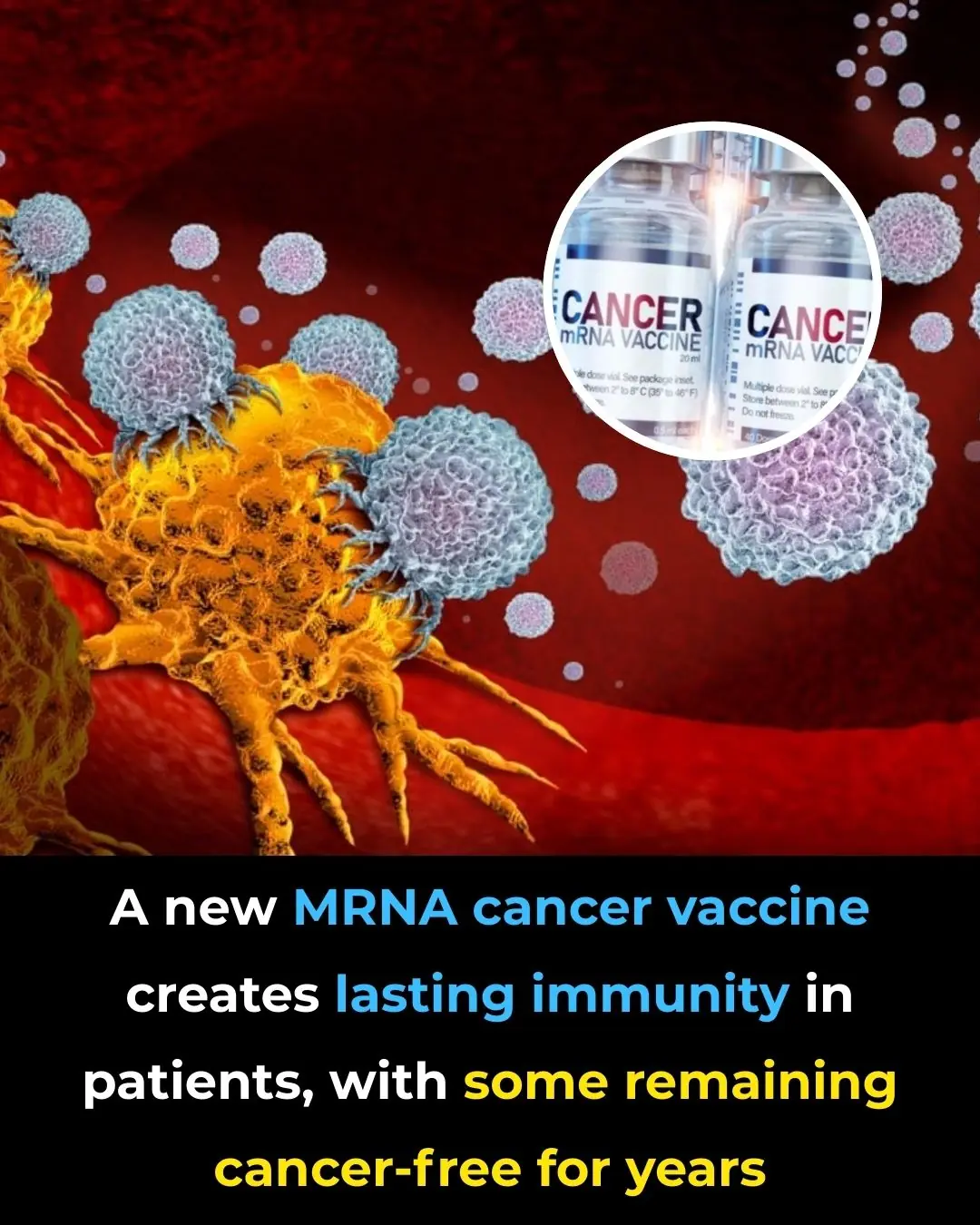 New mRNA Shot Turns Immune Cells Into Cancer-Killers Directly Inside the Body, Study Finds