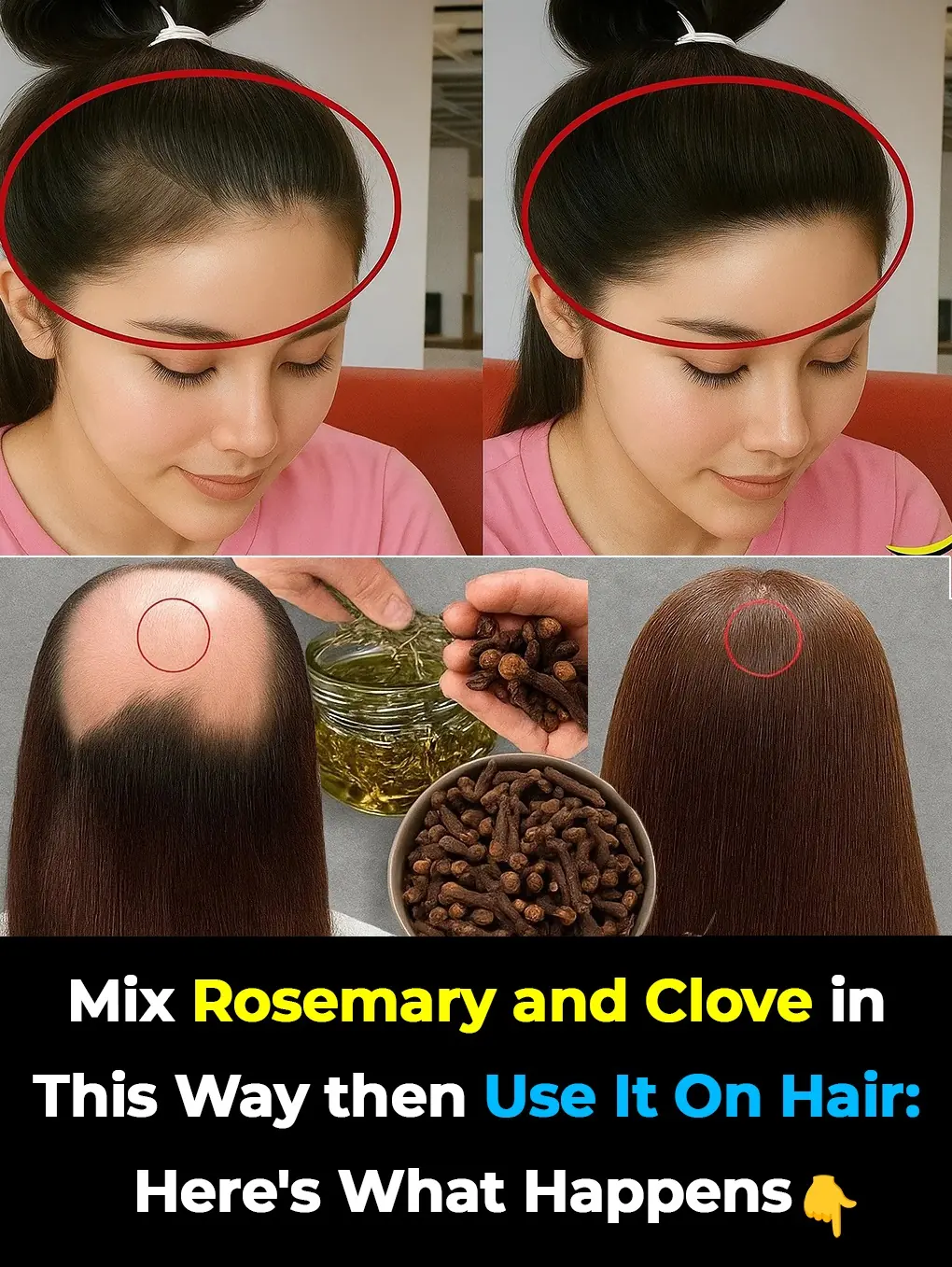Rosemary and Clove Remedy: Get Thicker, Longer Hair in Just 2 Weeks