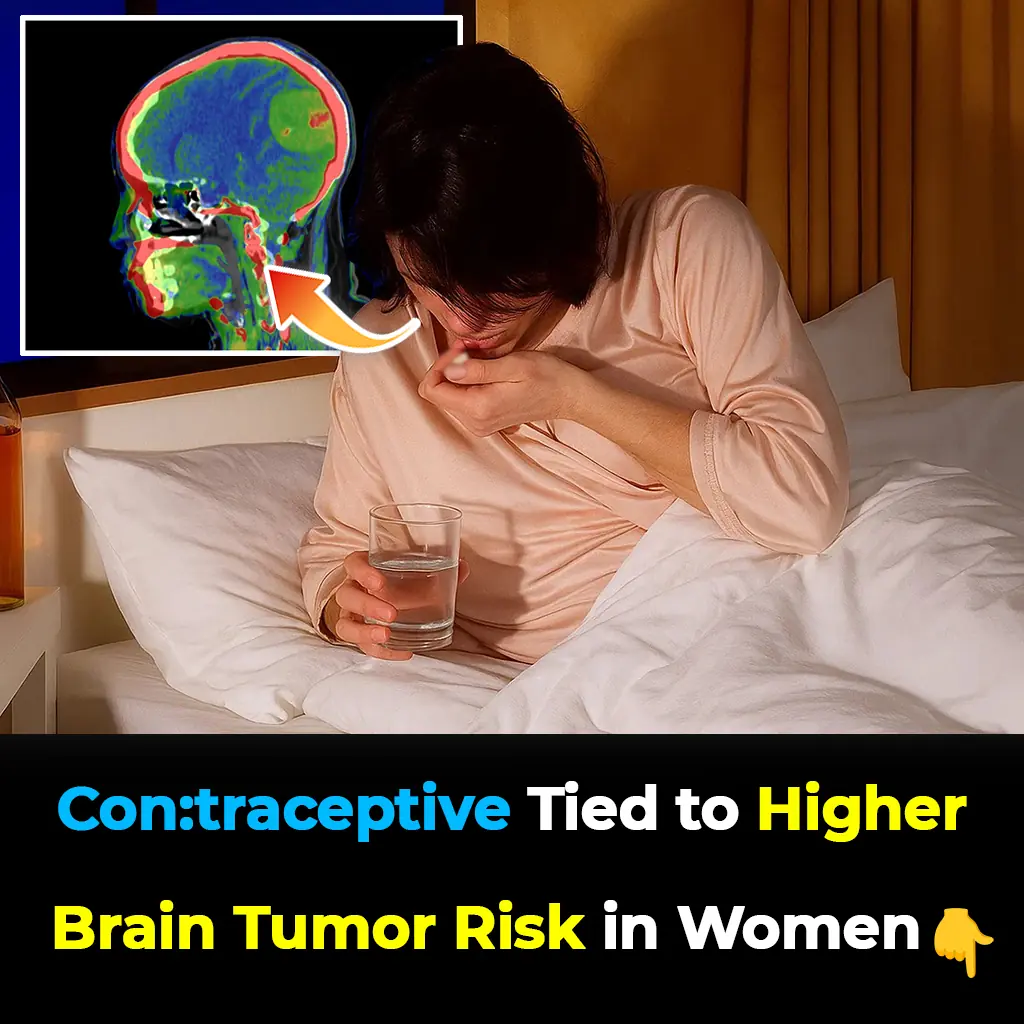 Shocking Study: Popular Birth Control Linked to Higher Brain Tumor Risk in Women