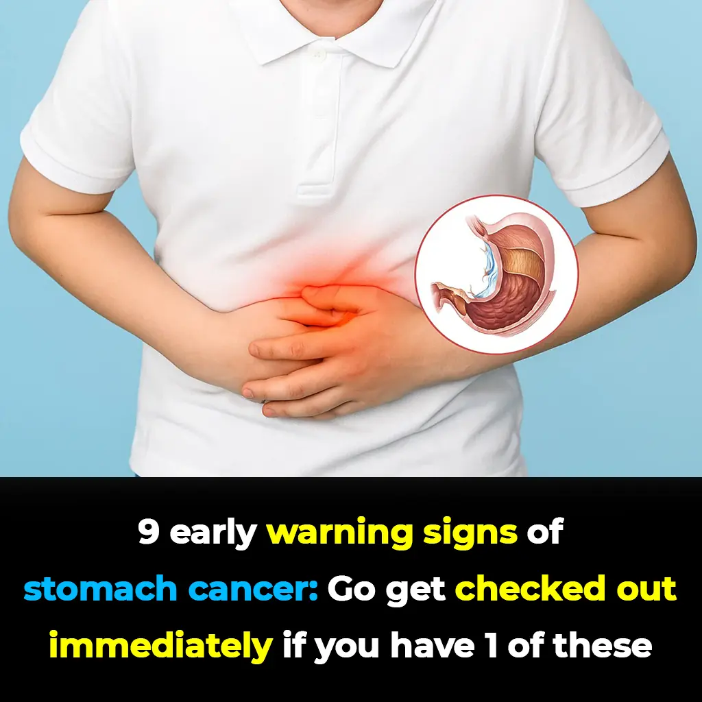 9 Early Warning Signs of Stomach Cancer You Should Never Ignore