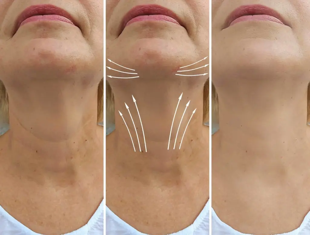 Why the Neck Sags with Age: Causes, Solutions, and Prevention Tips