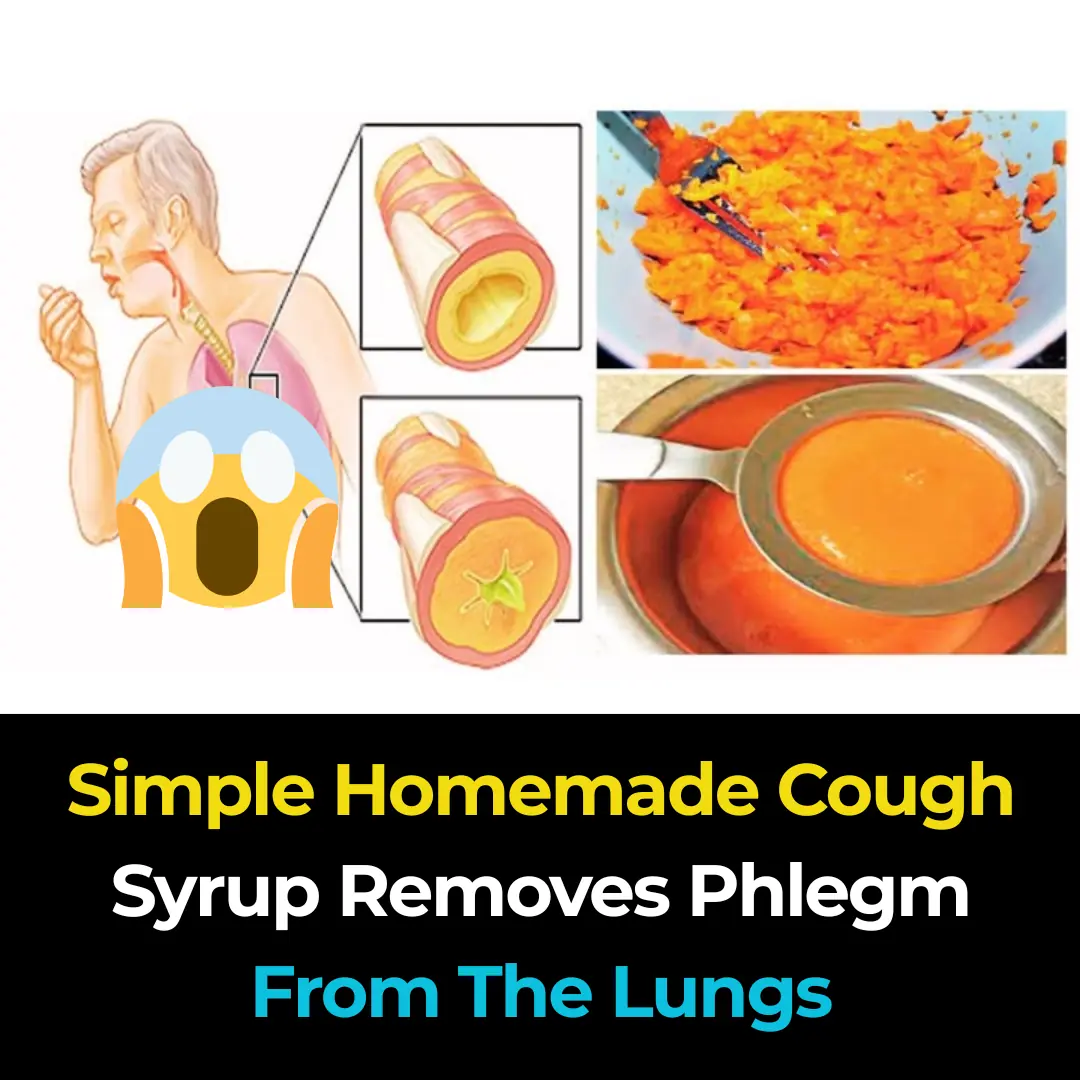 Simple Homemade Cough Syrup Removes Phlegm From The Lungs