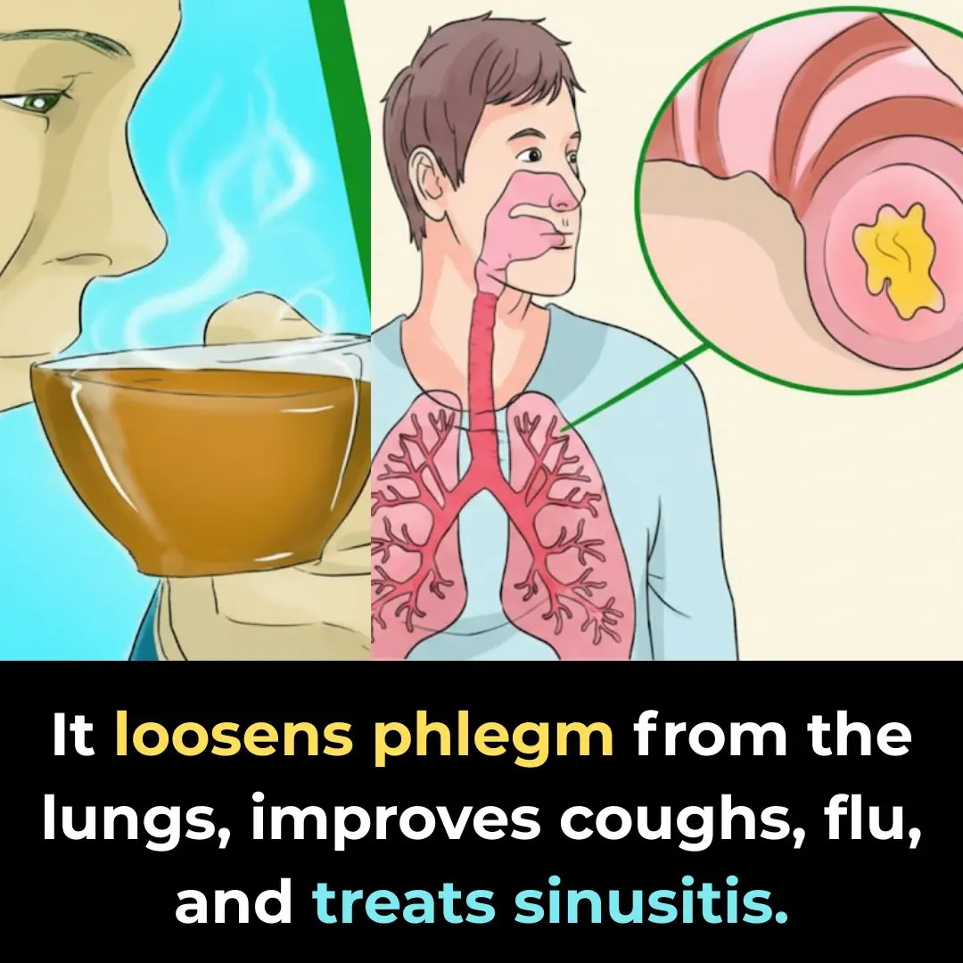 How To Get Rid of Phlegm And Mucus