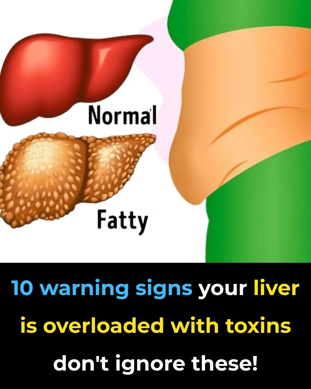 Early Signs of Liver Damage & How to Strengthen Your Liver