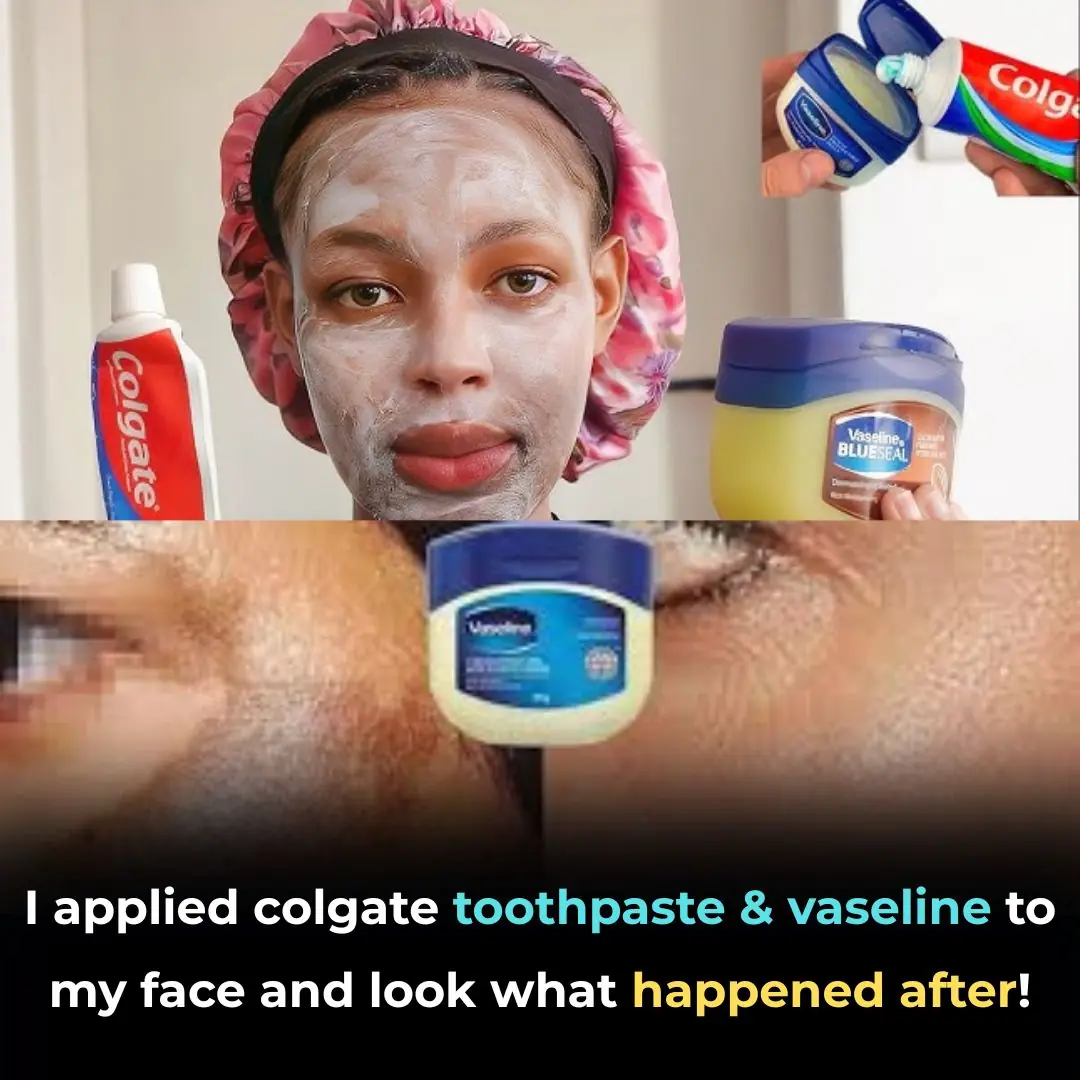 Toothpaste and Vaseline: The Viral Skincare Hack