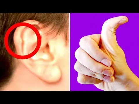 Rare Body Features That Show Just How Incredible the Human Body Is