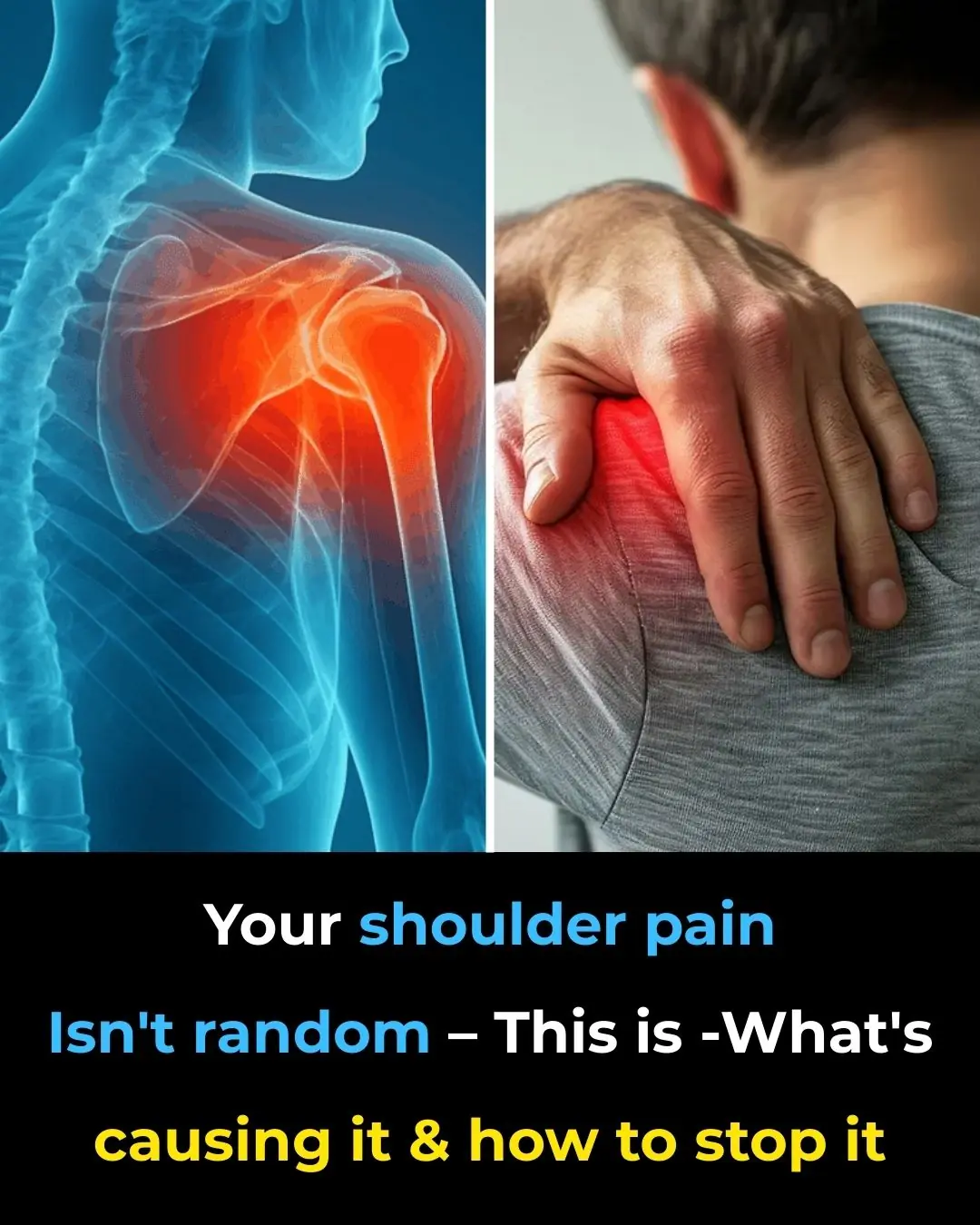 Shoulder Pain from Sleeping: Causes, Solutions and More