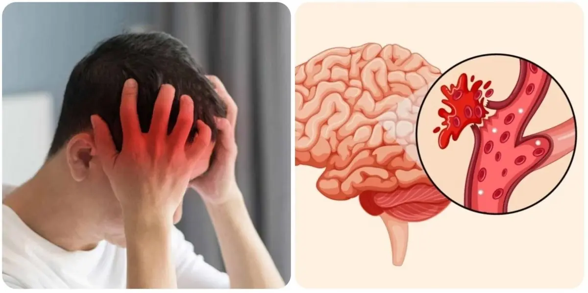 Heatwave of 41°C Causes Sudden Strokes in Healthy People: Doctors Warn of 7 Early Signs to Watch For