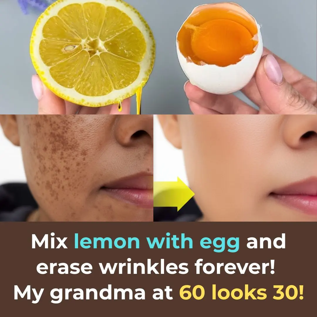 Mix Lemon with Egg and Erase Wrinkles Forever! My Grandma at 60 Looks 30!
