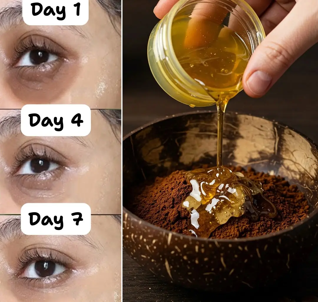 Say Goodbye to Dark Circles with Coffee: A Simple DIY Remedy for Youthful Eyes