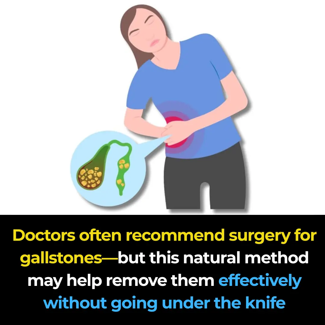 The Most Effective Natural Way to Remove Gallstones