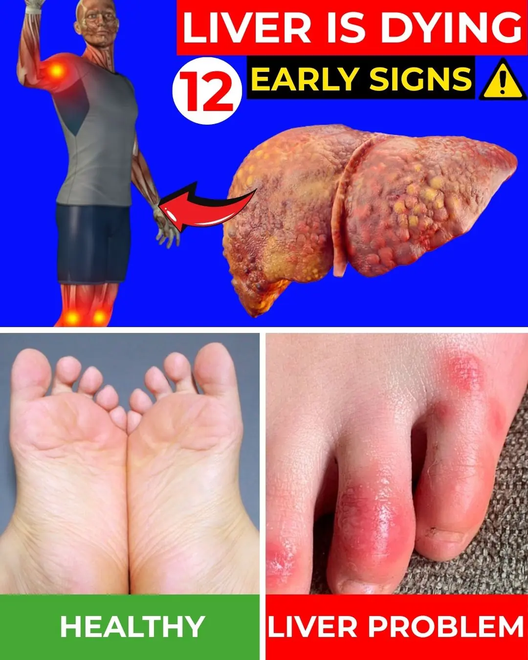 12 Early Signs Your Liver Is Dying: What Your Feet Reveal About Liver Health