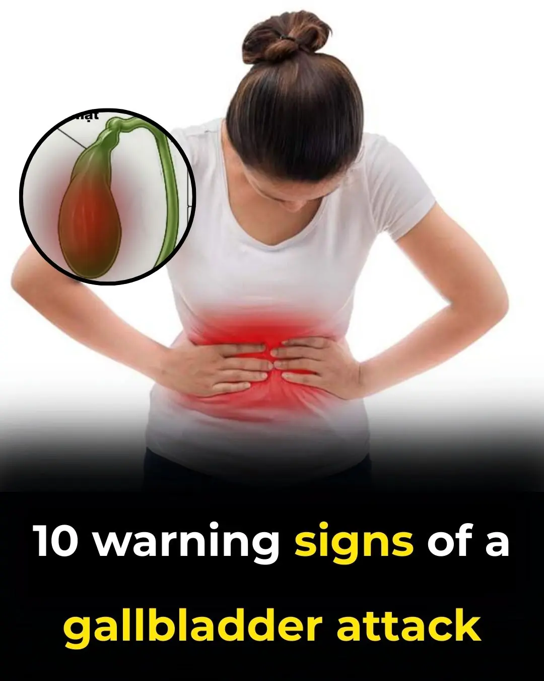 Top 10 signs of a gallbladder attack