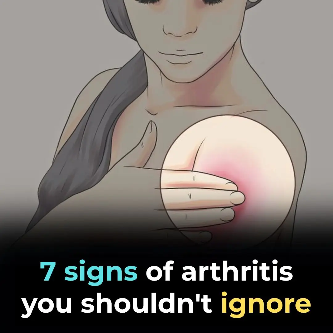 Signs of Arthritis You Shouldn’t Ignore