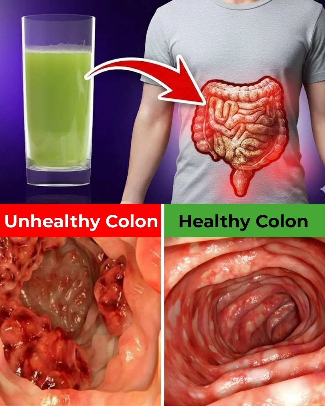 17 Natural Habits to Keep Your Colon Healthy