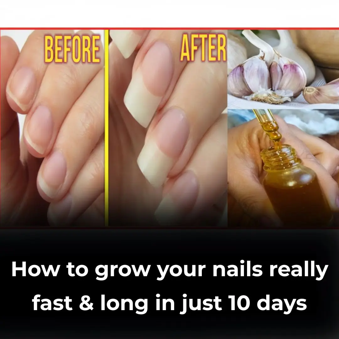 Revive Your Nails with This Garlic Secret