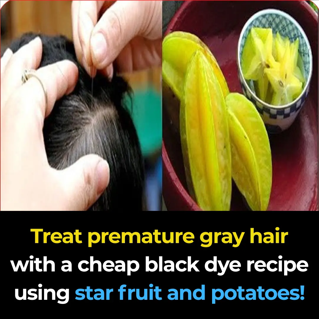 Treat premature gray hair with a black dye formula made from sour starfruit and potatoes, as cheap as can be!
