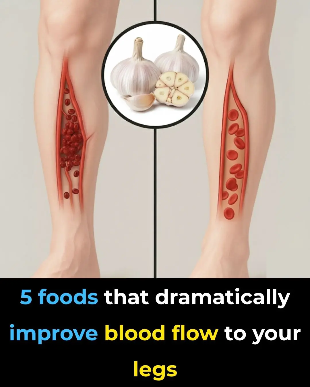 5 foods that dramatically improve blood flow to your legs