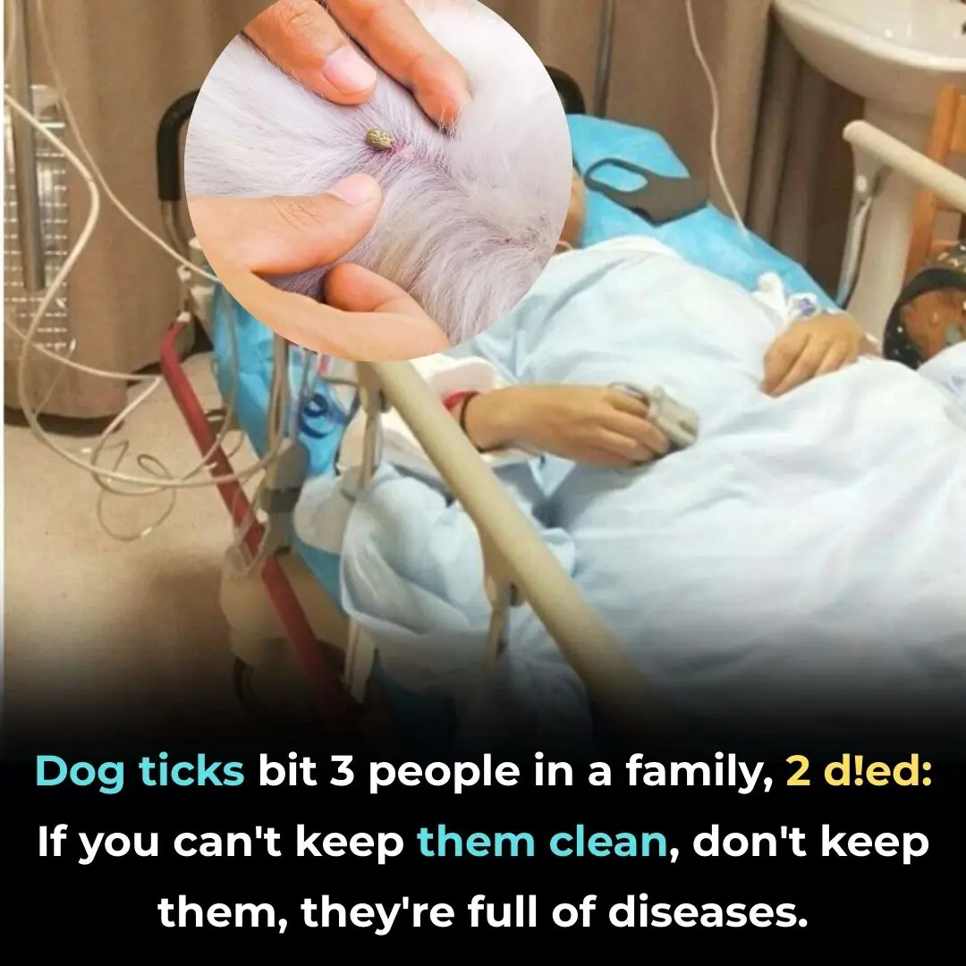 Dog ticks bit 3 people in a family, 2 died: If you can't keep them clean, don't keep them, they're full of diseases