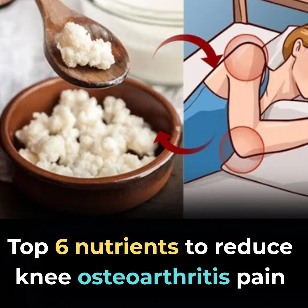 Top 6 Nutrients To Reduce Knee Osteoarthritis Pain