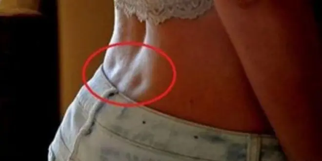 If You Have These Two ‘Dimples’ on Your Lower Back, This is What They Mean