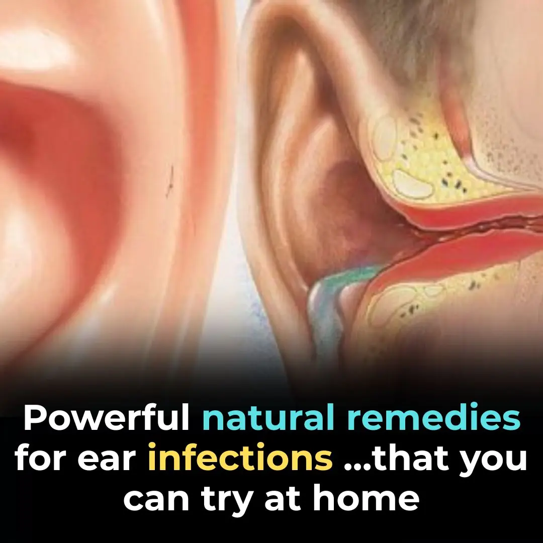Powerful Natural Remedies for Ear Infections