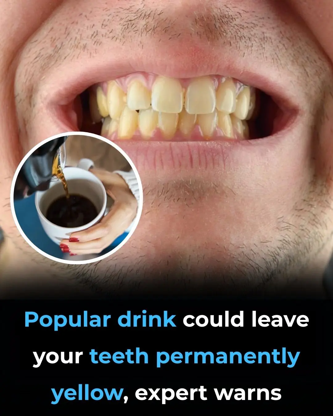 Popular Drink Could Be Permanently Staining Your Teeth