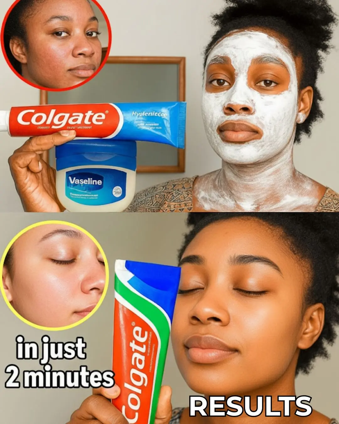 Toothpaste & Vaseline: The Viral Skincare Hack Unveiled