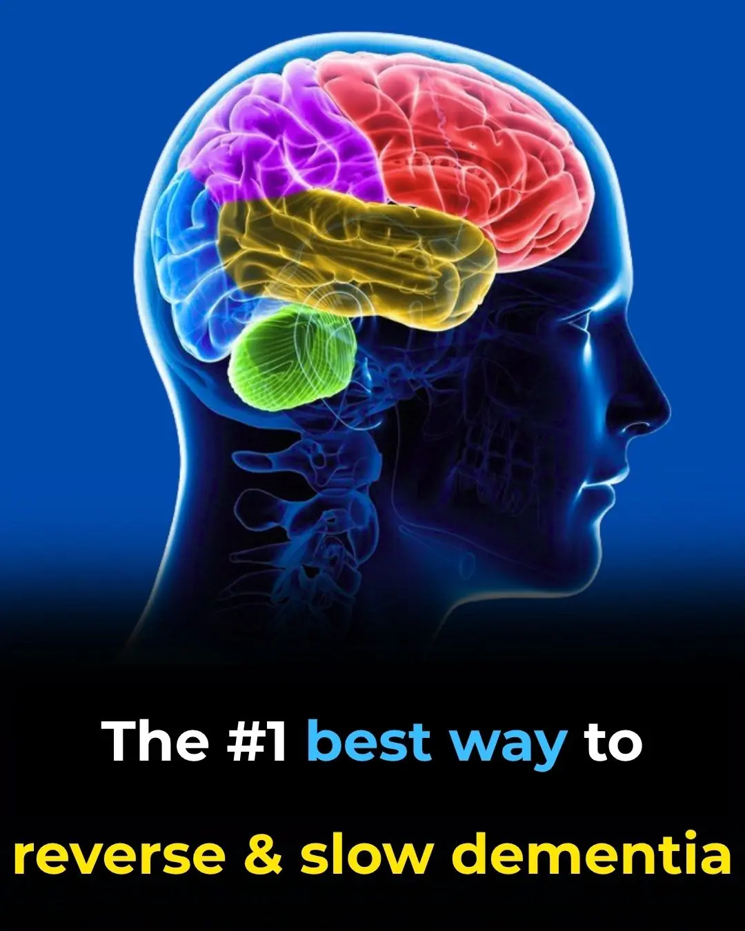 #1 best way to reverse & slow dementia
