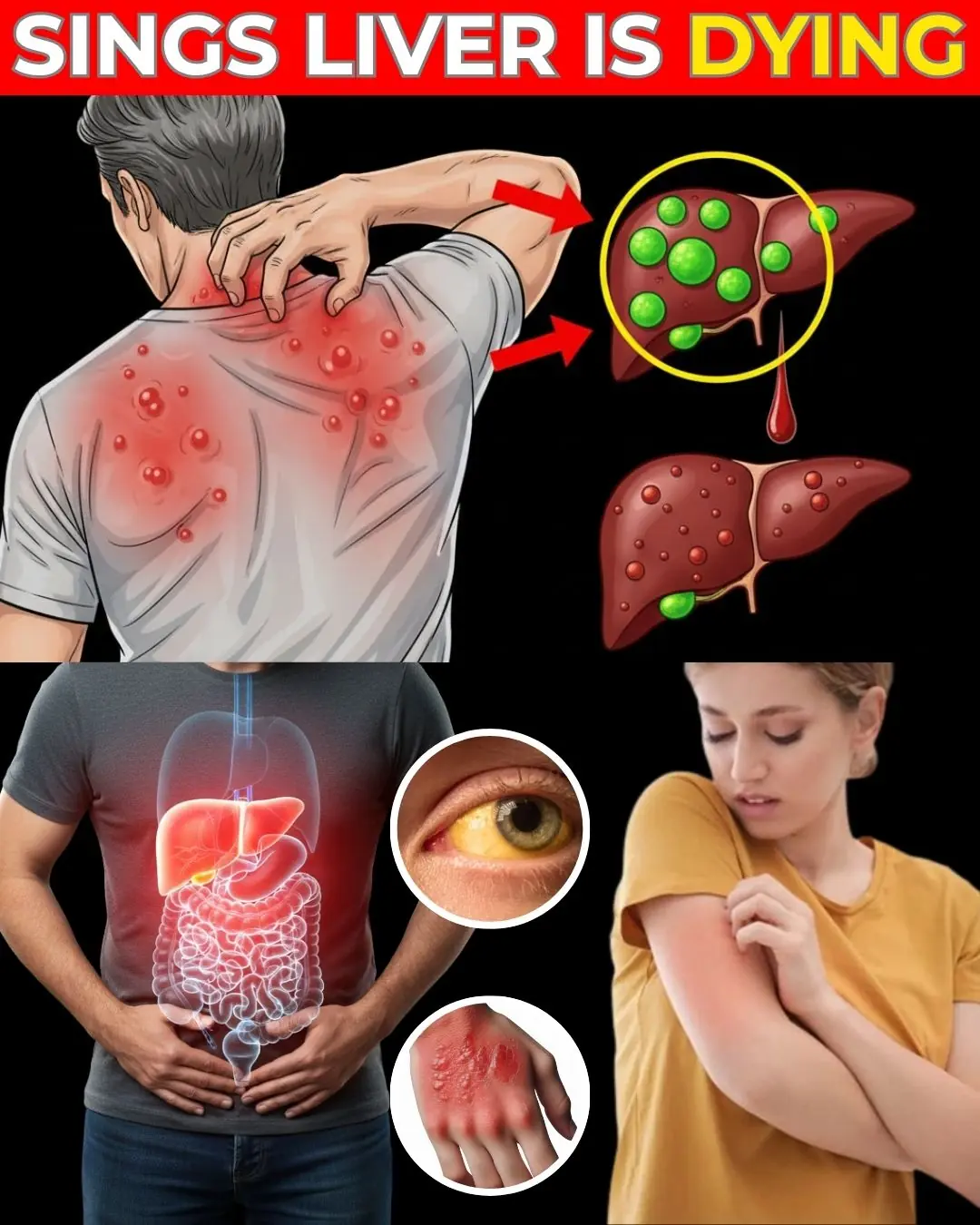 IS YOUR LIVER in DANGER? 12 Early Signs of LIVER CIRRHOSIS You Shouldn’t Ignore