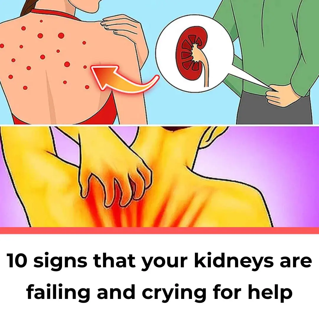 10 Symptoms of Kidney Disease