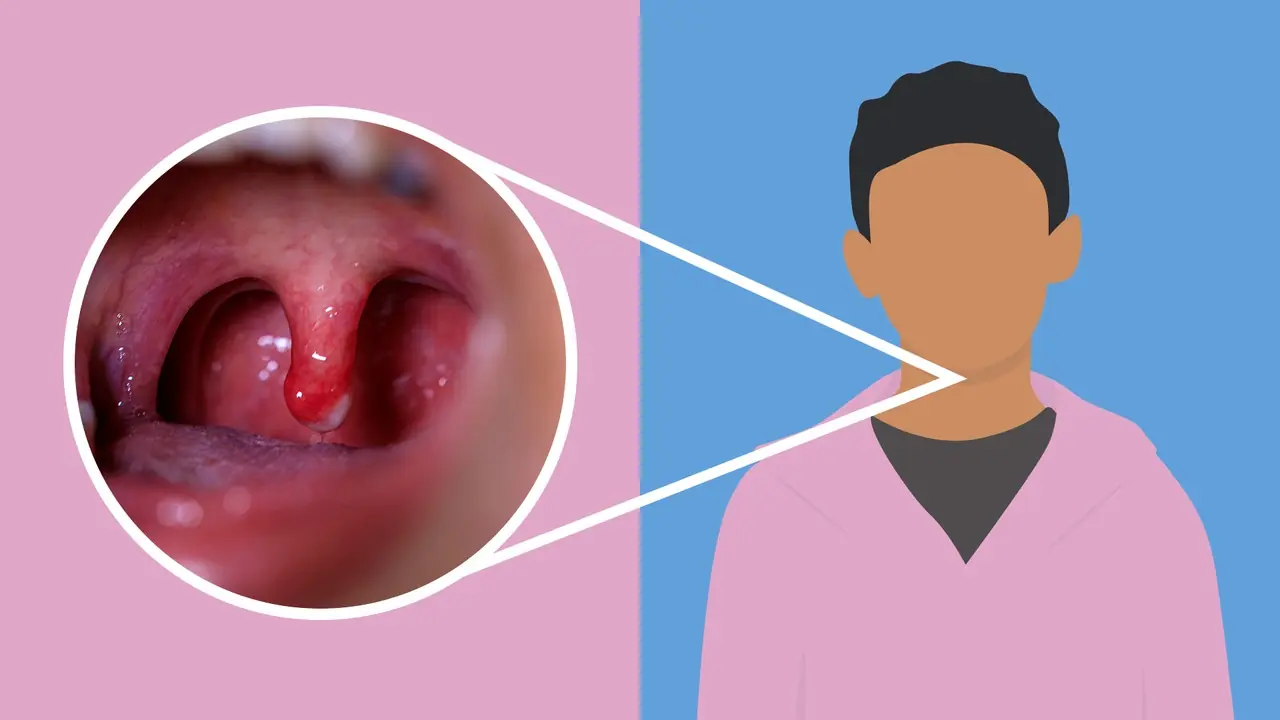 Get Rid of Throat Mucus Faster With These Highly Effective Natural Remedies