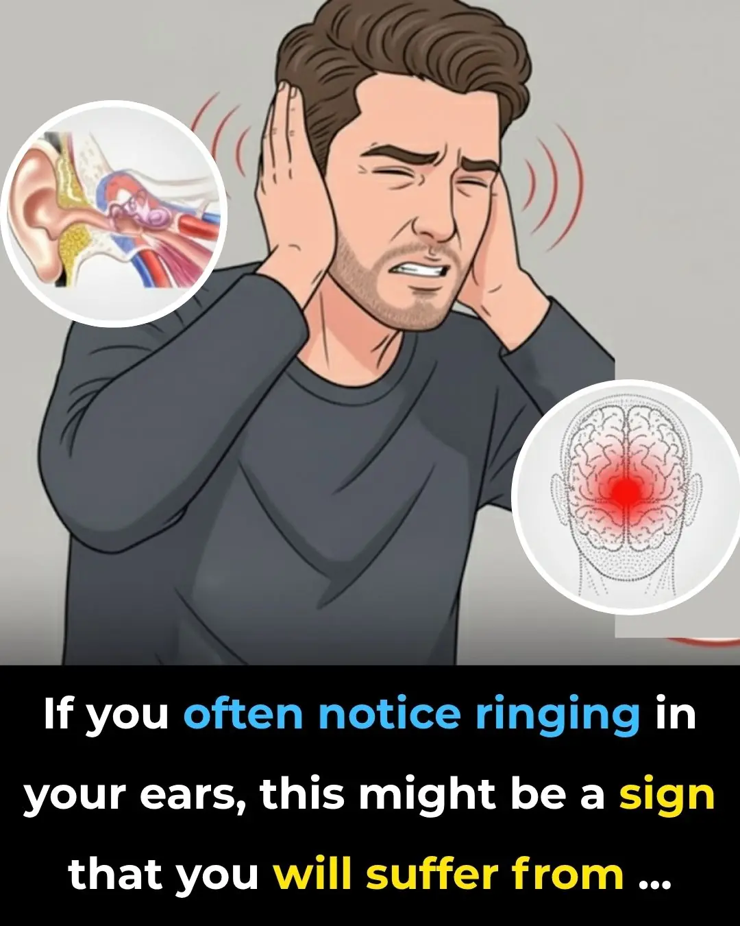 If you hear ringing in your ear, this is a sign that you will suffer from…