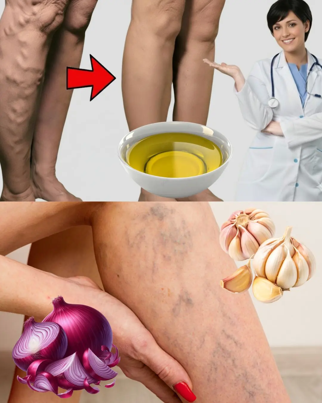 Garlic: Nature’s Secret to Soothing Varicose Veins Naturally