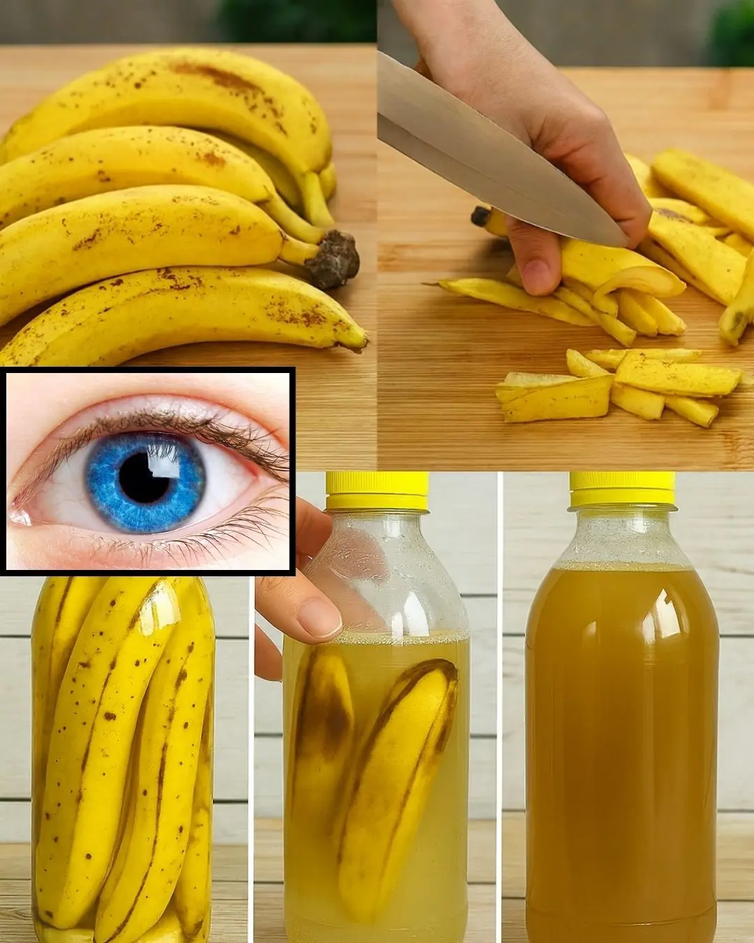 Don’t Toss Banana Peels If You Don’t Know How They Can Boost Your Wellness