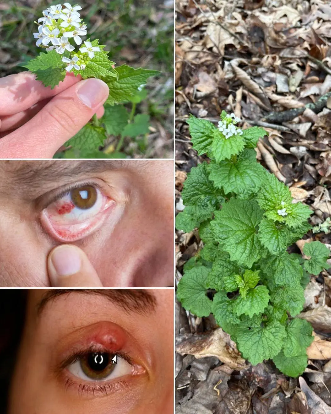 Garlic Mustard: The Overlooked Herb That Can Boost Your Health — Especially Your Eyes