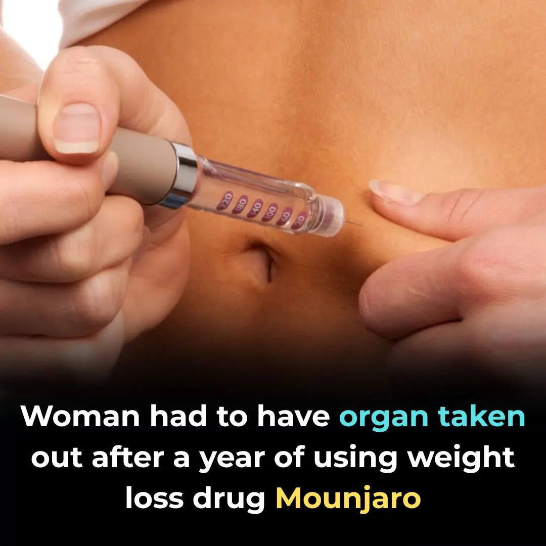 Woman had to have organ taken out after a year of using weight loss drug Mounjaro